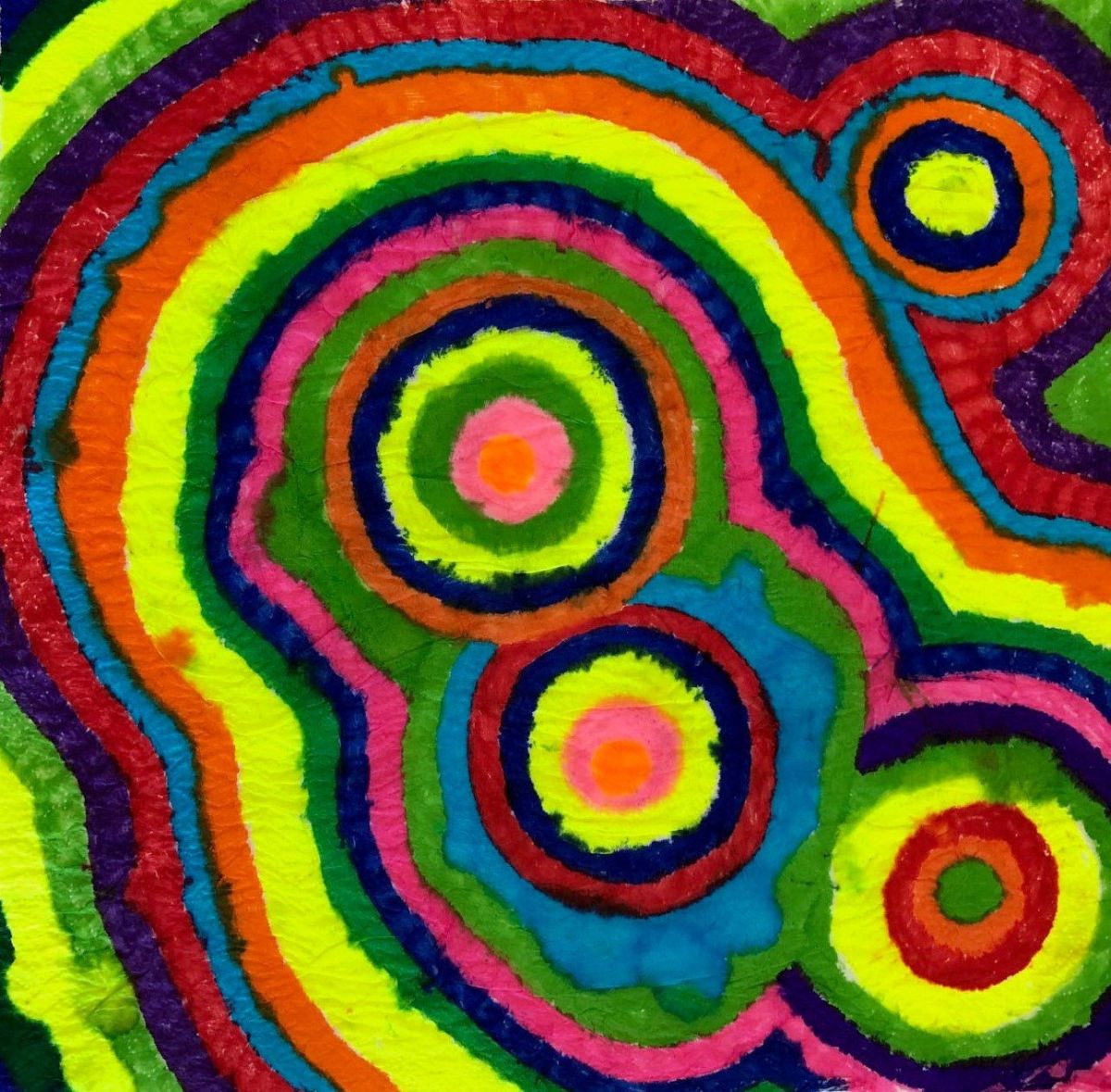 7 - Markers on tissue